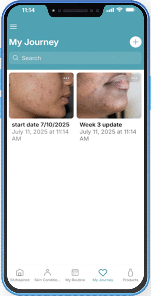 SKINSpired App My Journal Screen